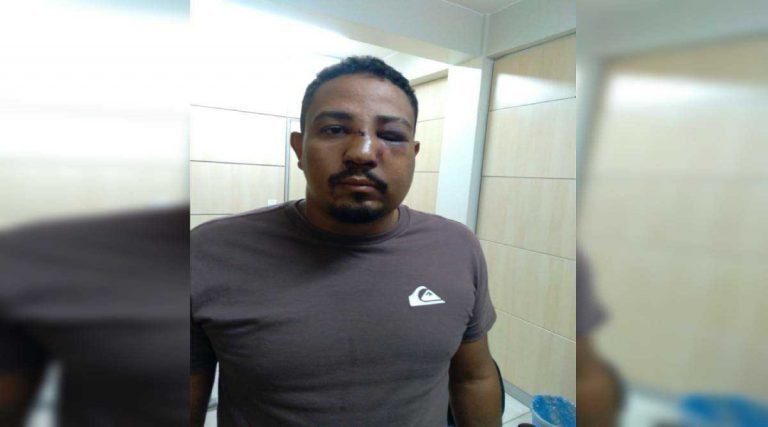 Cliente discorda de leitura de tarô e espanca cartomante no DF