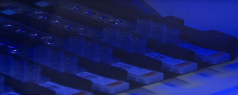 Após uma semana sem reagentes, Lacen recebe material e fila com mais de 1,2 mil exames deve reduzir