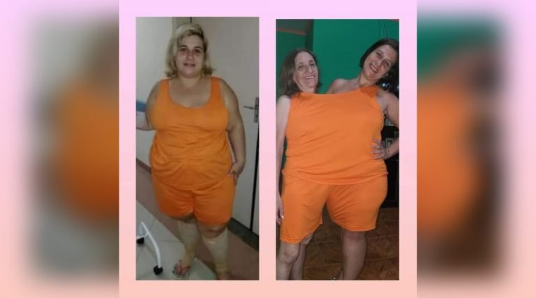 Tarauacá: Após drama da obesidade, mulher conta como perdeu 50 quilos