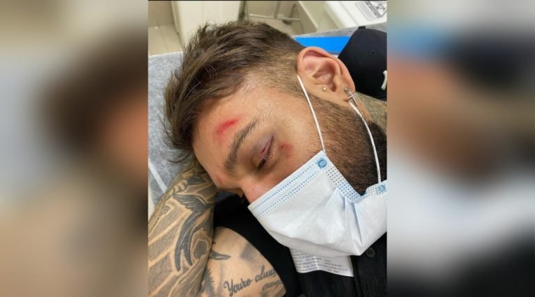 Lucas Lucco tranquiliza fãs após queda dentro de casa em Uberlândia: ‘História para contar’