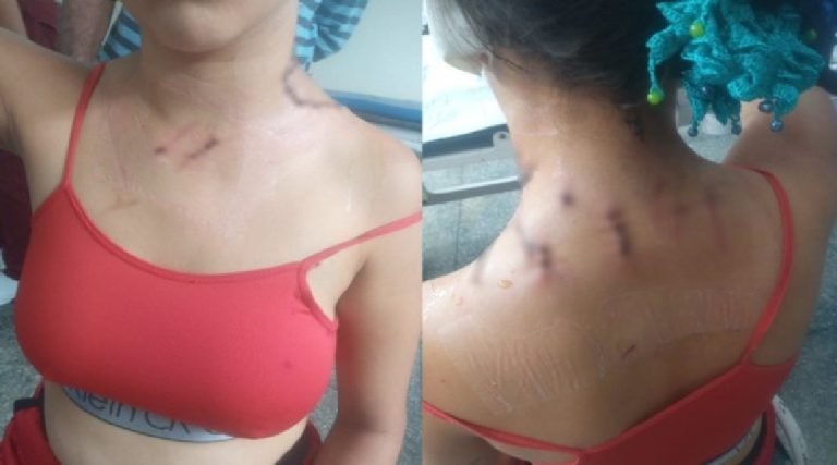 Mulher é ferida com 10 facadas pelo marido: ‘sentimento é de medo’