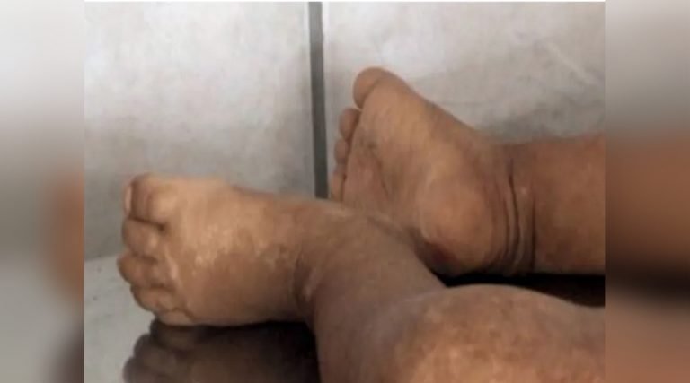 Associação Yawanawa pede exumação do corpo de bebê indígena que foi sexualmente abusada