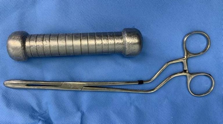 Médicos encontram peso de academia de 2 quilos dentro de paciente