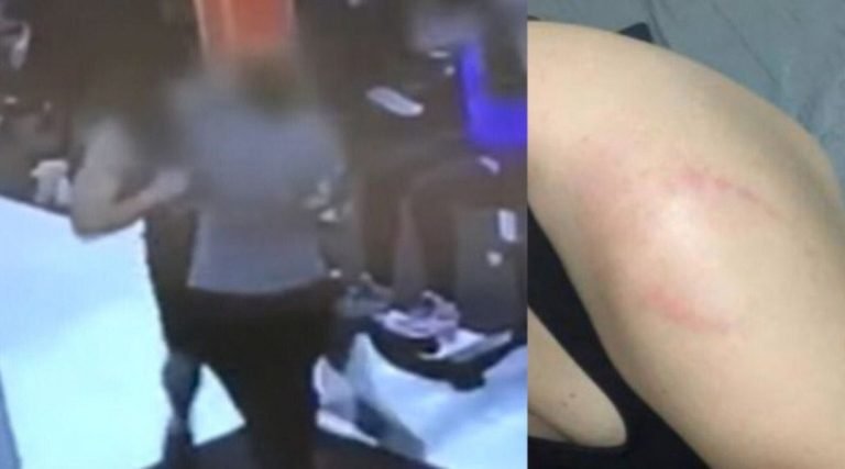 “Fiquei com medo”, diz jovem atacada com mordida na academia em Goiás