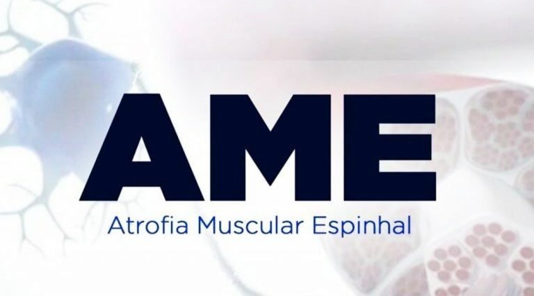 Coluna da Ritinha- Atrofia Muscular Espinhal