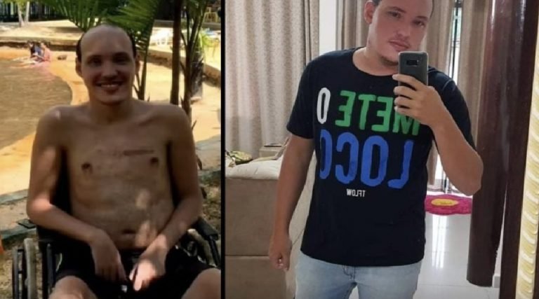 Com síndrome rara, cruzeirense volta a andar após 3 anos de tratamento