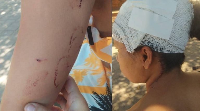 Homem é preso por tentativa de feminicídio em Rio Branco