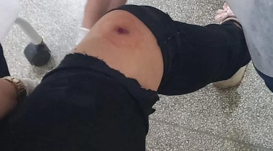 No AC, mulher reage a assalto e é ferida a tiros por criminoso