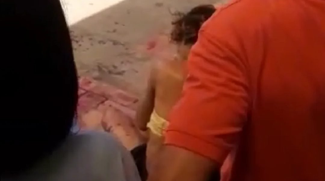 No Acre, mulher em situação de rua é agredida com golpes de terçado