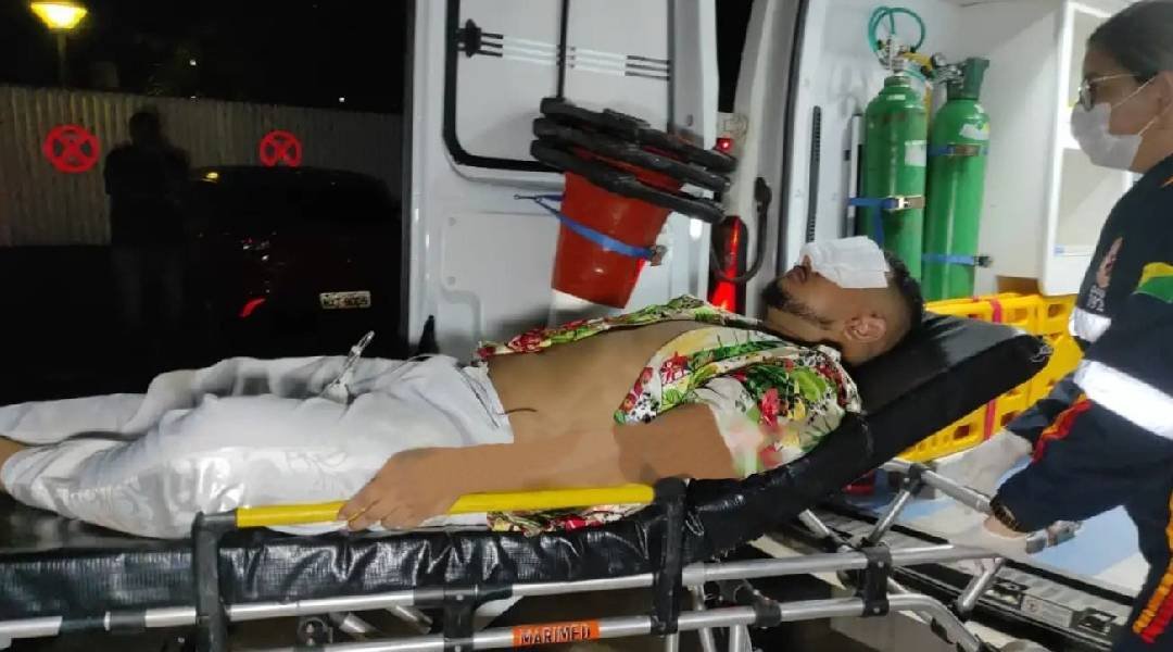 Jovem tem olhos feridos após soltar uma bomba em arraial fora de época