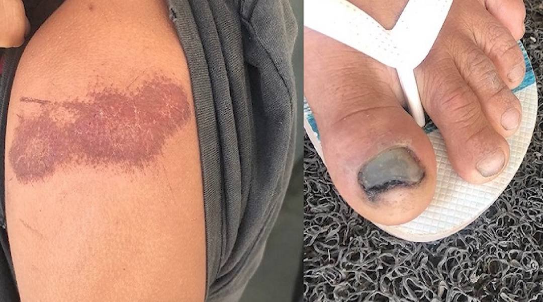 Agentes do Gefron são acusados de torturar jovens na zona rural de Cruzeiro do Sul