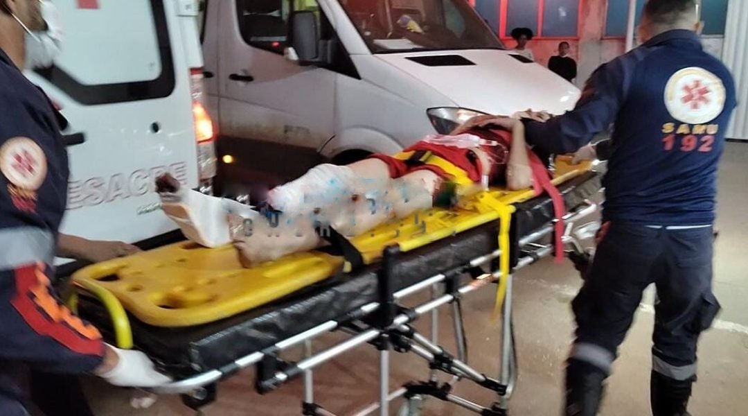 Adolescente de 13 anos é atropelado por motociclista ao tentar atravessar rua em Rio Branco