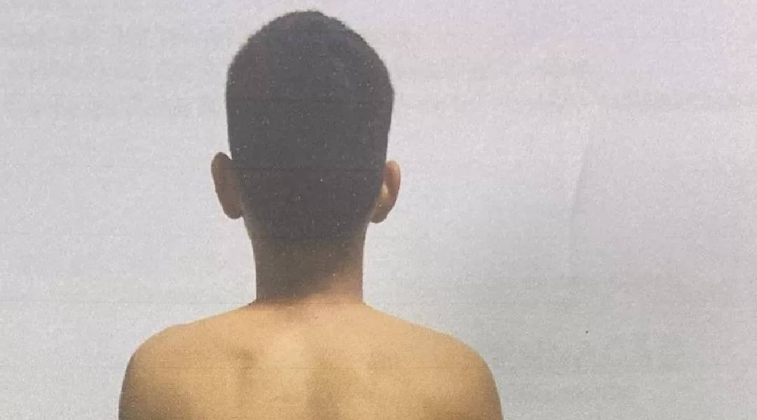 Dois menores são aprendidos e um maior é preso por invasão no Hospital de Feijó