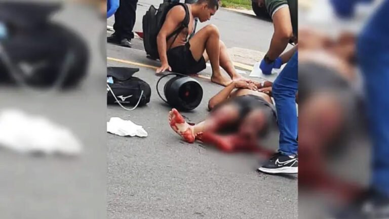 Acidente envolvendo duas motocicletas deixa um homem ferido com fratura exposta na AC-405 em Cruzeiro do Sul