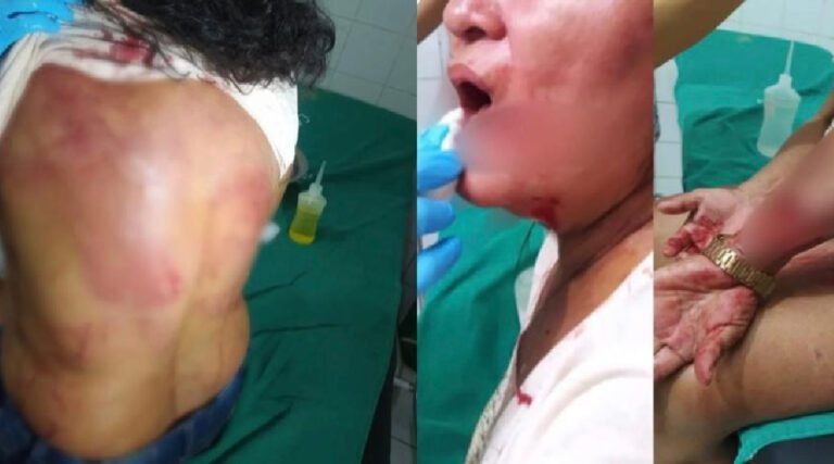 Mulher é resgatada pela polícia após ter cabelo, roupas e corpo cortados com faca pelo marido no Acre