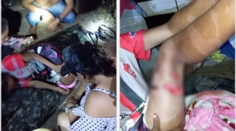 Moradora do Rio Purus é atacada por jacaré