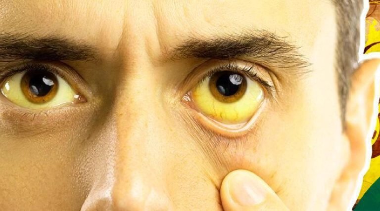 Criança morre com suspeita de febre amarela no Hospital do Juruá