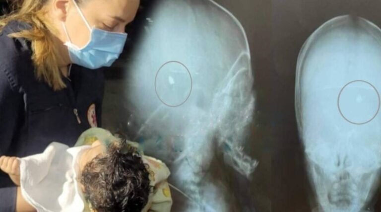 Bebê de 4 meses alvejado com tiro na cabeça morre em hospital de Rio Branco