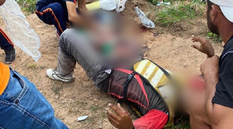  Mototaxista tem perna amputada após acidente com veículo da Ageac na BR-364