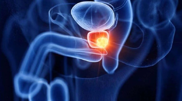 Acre registra 141 casos de câncer de próstata entre 2023 e 2024, mostram dados da saúde