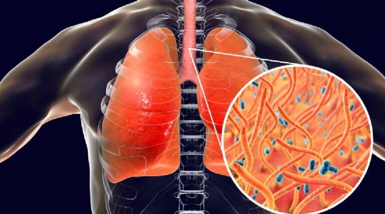 Coqueluche: Acre é um dos únicos estados que não registraram casos em 2024