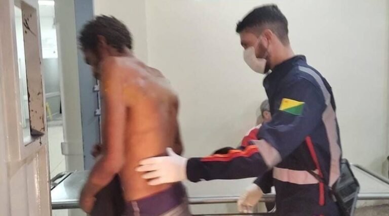 Morador em situação de rua é espancado por faccionados após ser acusado de furto em Rio Branco