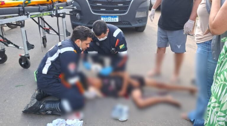 Criança de 10 anos fica gravemente ferida após ser atropelada por moto em Cruzeiro do Sul