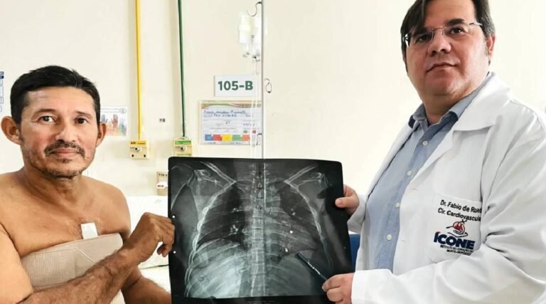 Em caso raro, produtor rural sobrevive após levar tiro no coração por acidente com rifle no Acre