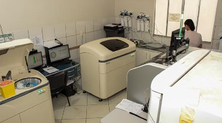 Quedas de energia danificam equipamento de exames hormonais em Cruzeiro do Sul
