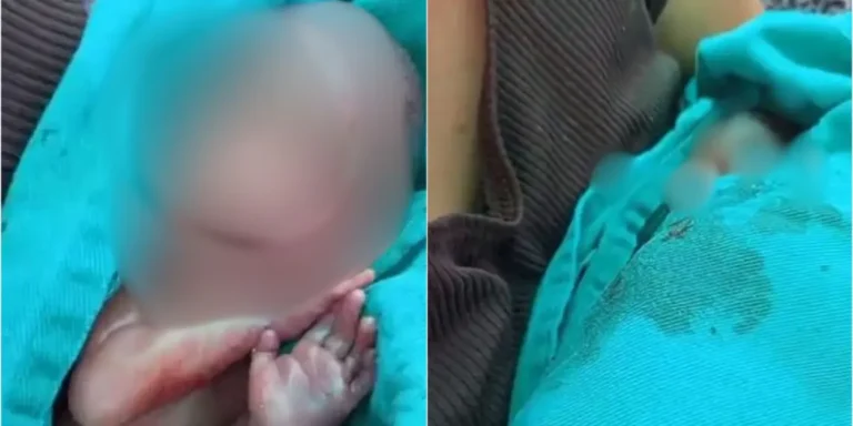 Bebê declarado morto volta a apresentar sinais vitais, mas morre dois dias depois em Rio Branco