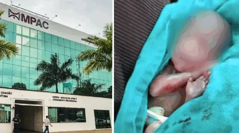 Milagre ou negligência? O bebê que voltou à vida antes do sepultamento no Acre