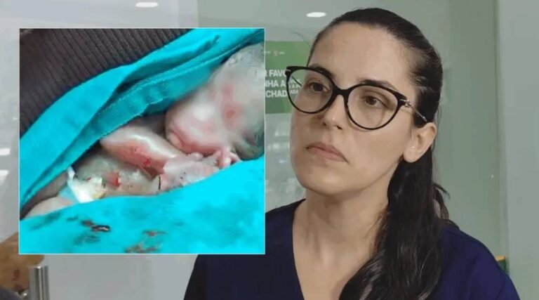 “É uma situação excepcional, pode acontecer”, afirma neonatologista sobre bebê prematuro