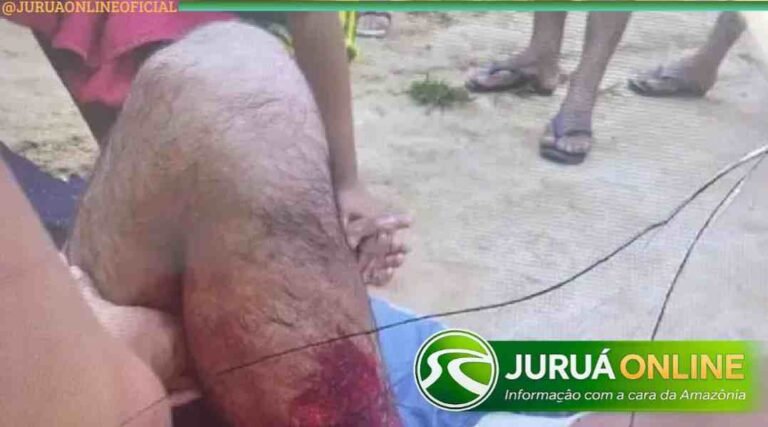 Indígena é operado após tiro acidental durante caça no interior do Acre