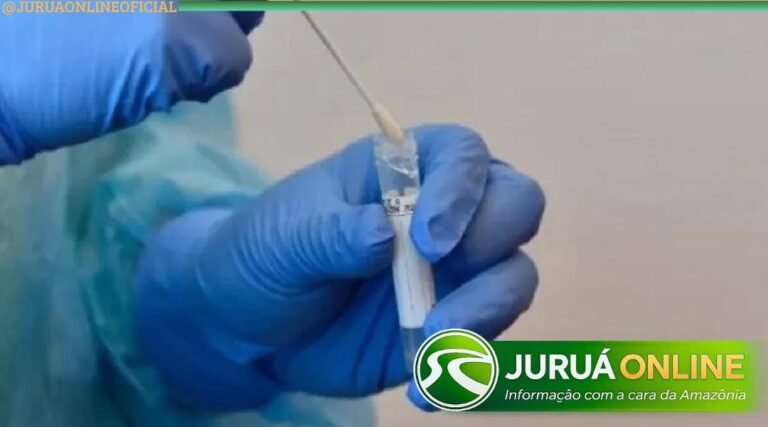 Boletim aponta circulação de Influenza A, VSR e rinovírus no Acre