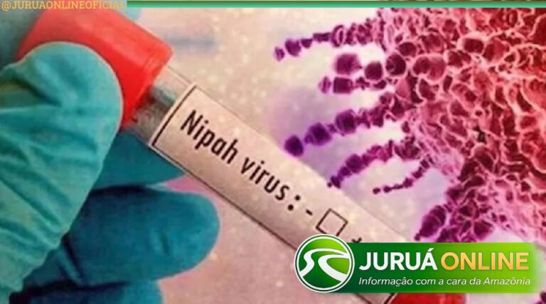 Universidade de Tóquio desenvolve vacina promissora contra o vírus Nipah
