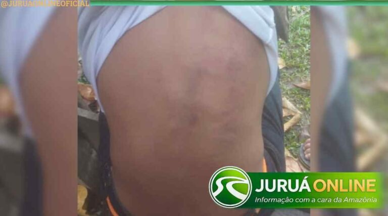Vídeo de agressão contra indígena em Jordão mobiliza investigação policial