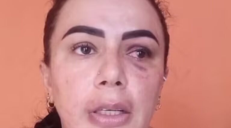 Mulher acusa policiais de supostas agressões no interior do Acre