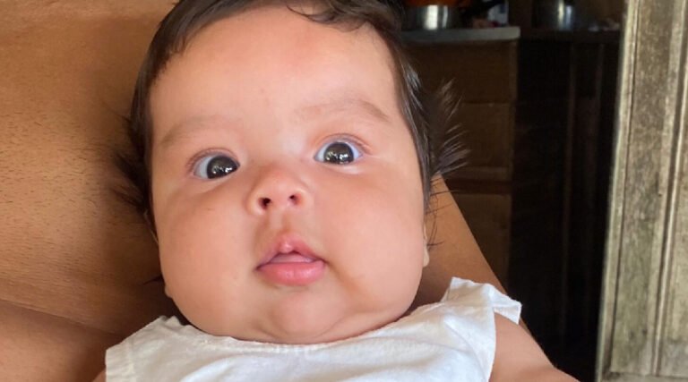 Bebê de 3 meses é diagnosticada com tumor na cabeça e família pede ajuda em Cruzeiro do Sul