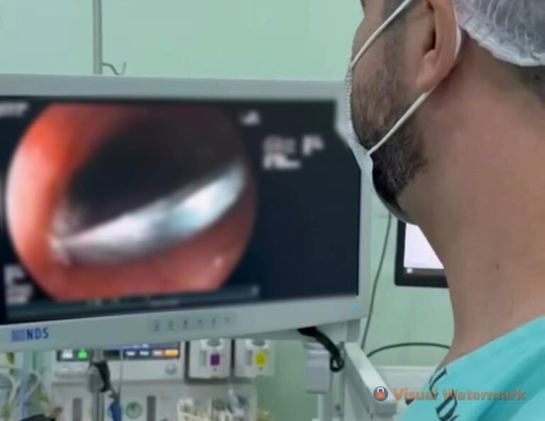 Criança de 3 anos engole moeda e passa por endoscopia de emergência no Hospital do Juruá