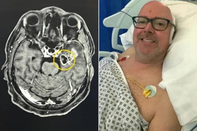 Homem atribui tontura à falta de álcool e descobre tumor cerebral agressivo
