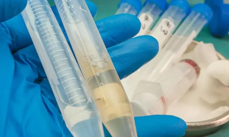 Acre registra 13 casos de meningite e uma morte em 2026; Cruzeiro do Sul concentra maior número de confirmações