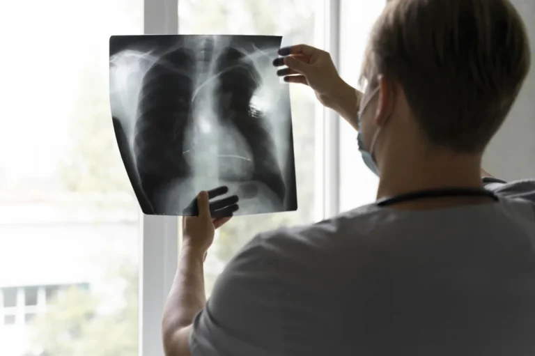 Anvisa aprova novo medicamento para câncer de pulmão com mutação genética