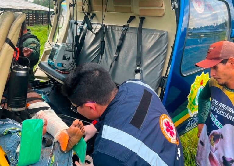 Homem atingido por árvore em roçado é resgatado de helicóptero e passa por cirurgia em Cruzeiro do Sul