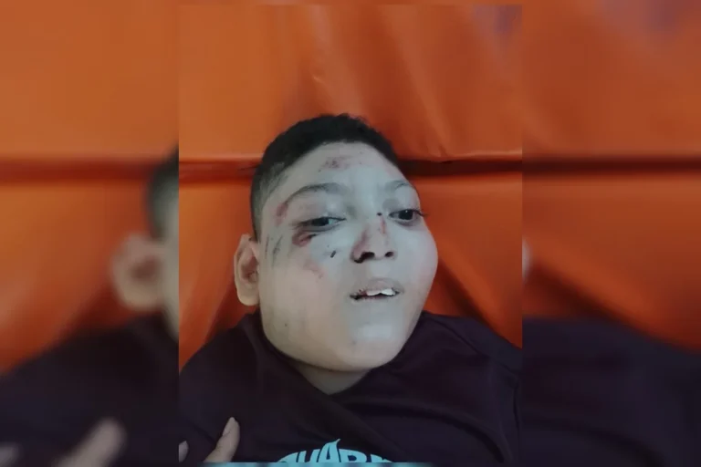 Menino cadeirante fica ferido após cair de escada rolante no Metrô-DF e é internado na UTI