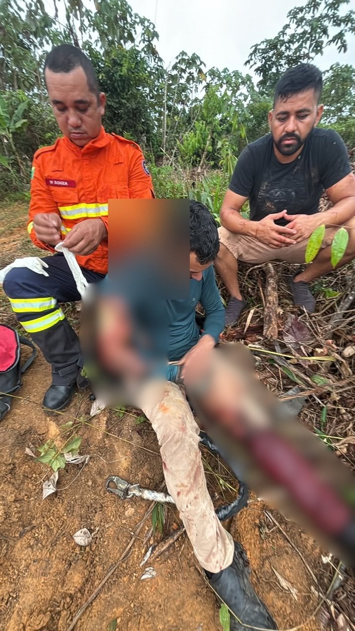 Descarga elétrica deixa trabalhador ferido durante manutenção na rede elétrica em Mâncio Lima