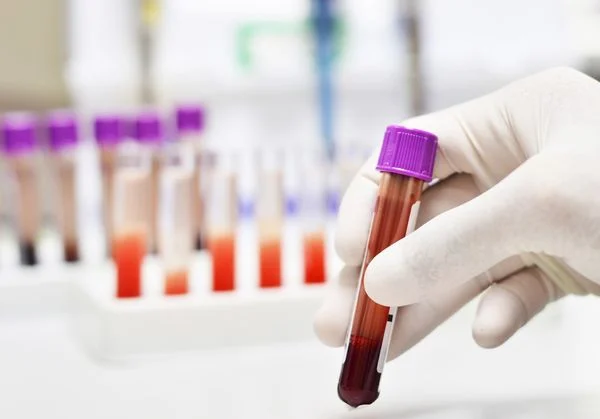 tubo-de-ensaio-com-coleta-de-sangue-card_m-1
